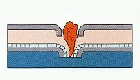 さらに第2層が破れても特殊補強層がしっかり受け 止め、優れた粘着剤により止水性能が保たれます。